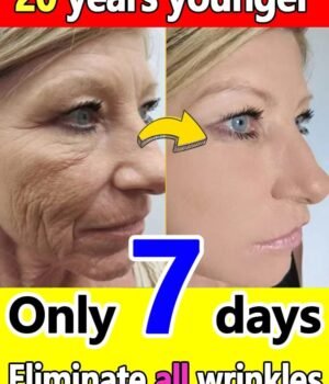 Anti-Aging Skincare Serum – Visible Fine Line Support