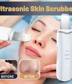 Ultrasonic Skin Scrubber – Ion Deep Pore Cleanser